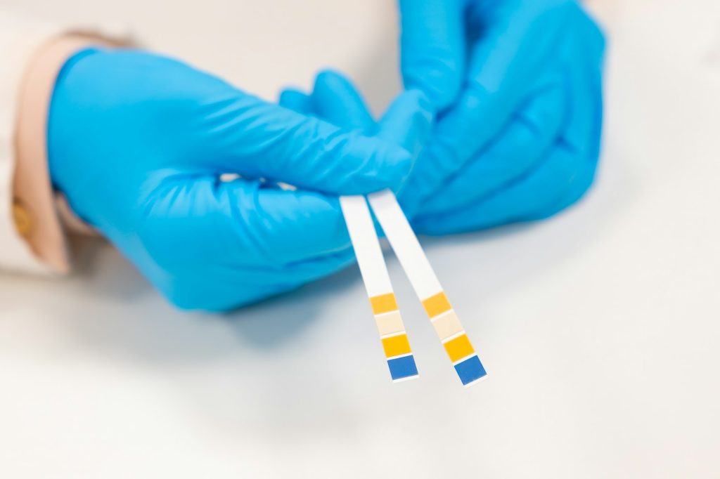 scientist hands in rubber gloves holding ph paper
